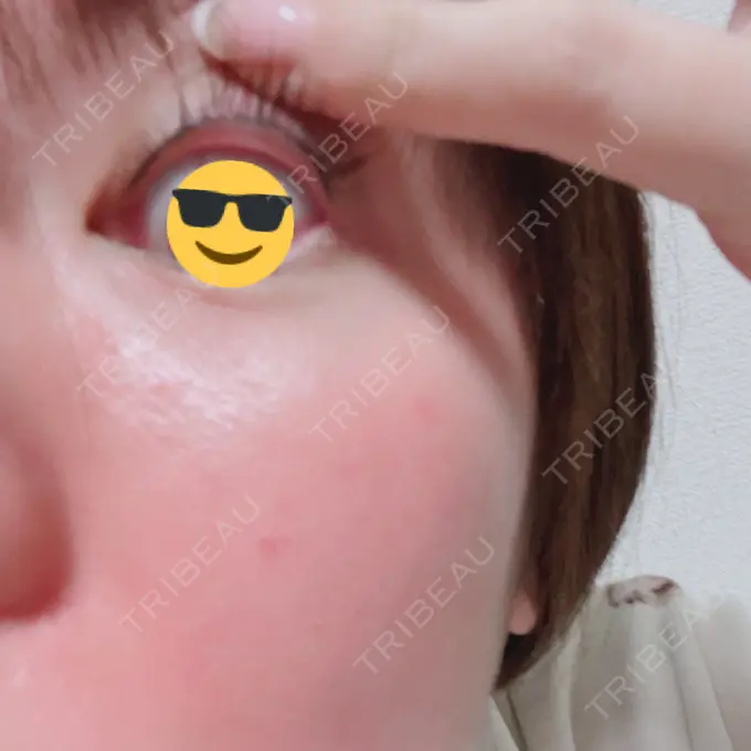 アートメイク（アイライン） 筋肉・美容クリニック AFTER メイン用