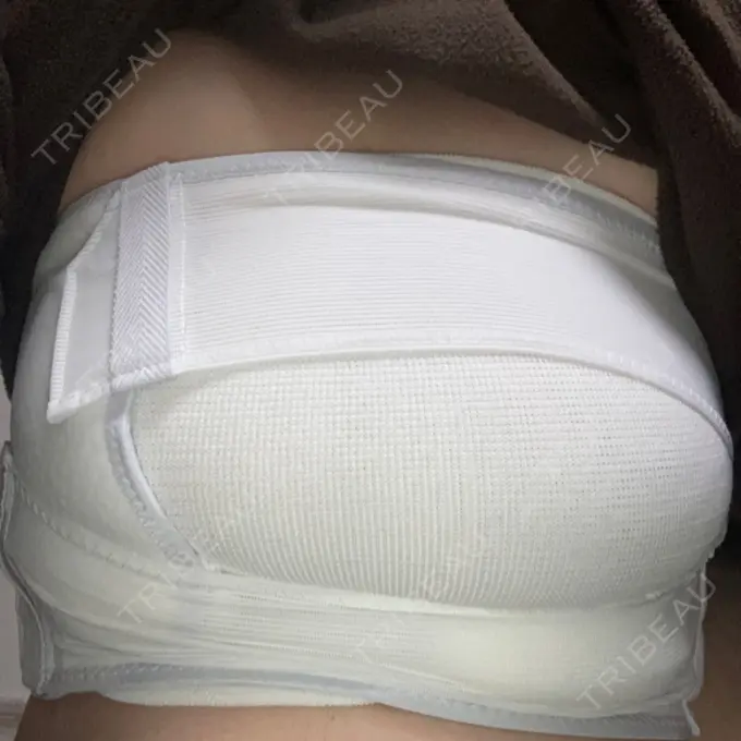 胸修正 / その他（胸） 湘南美容クリニック 神戸三宮院 DAY 1 メイン用