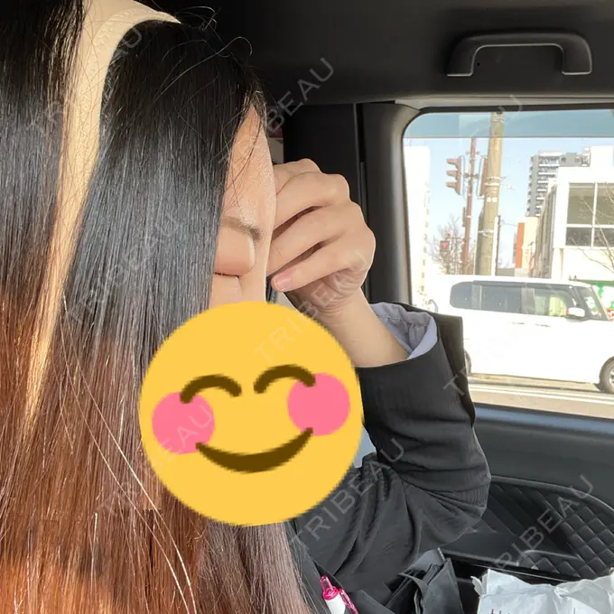 糸リフト / 脂肪吸引（顔） / 脂肪注入（額） X CLINIC 恵比寿院 DAY 2 メイン用