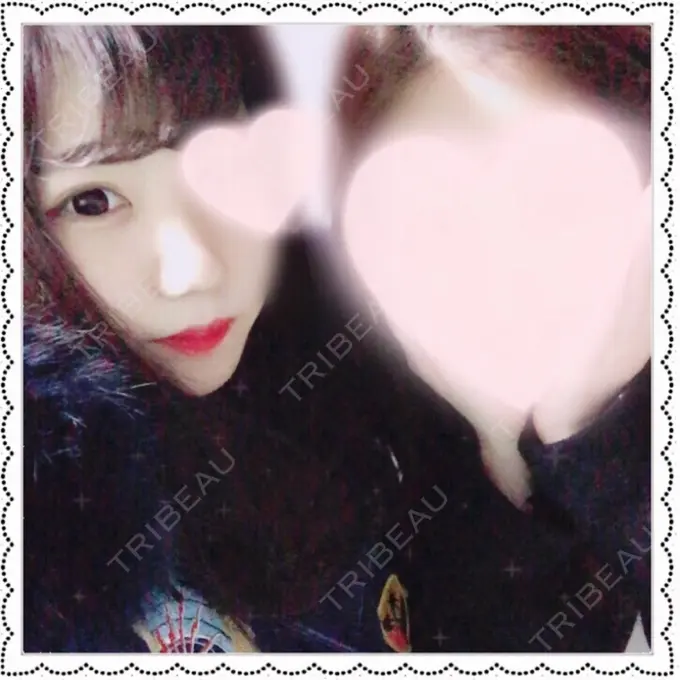 小鼻縮小（切開） Dual Clinic KOBE DAY 4 メイン用