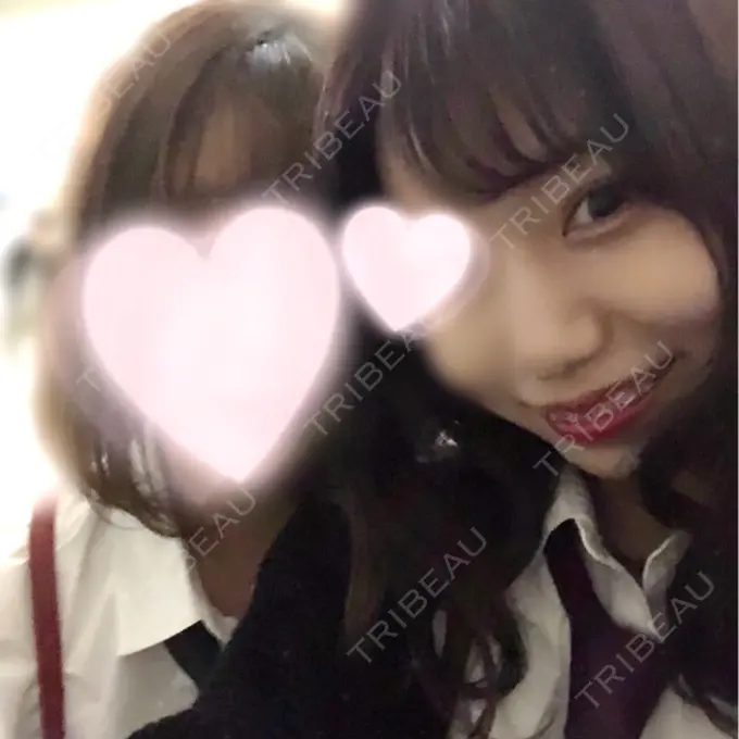 小鼻縮小（切開） Dual Clinic KOBE AFTER メイン用