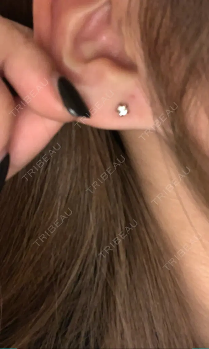 ピアス穴あけ アイ&スキンクリニック東京ソラマチ AFTER メイン用
