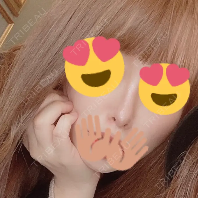 隆鼻術 / 鼻中隔延長（切開） / 脂肪吸引（顔） みずほクリニック AFTER メイン用