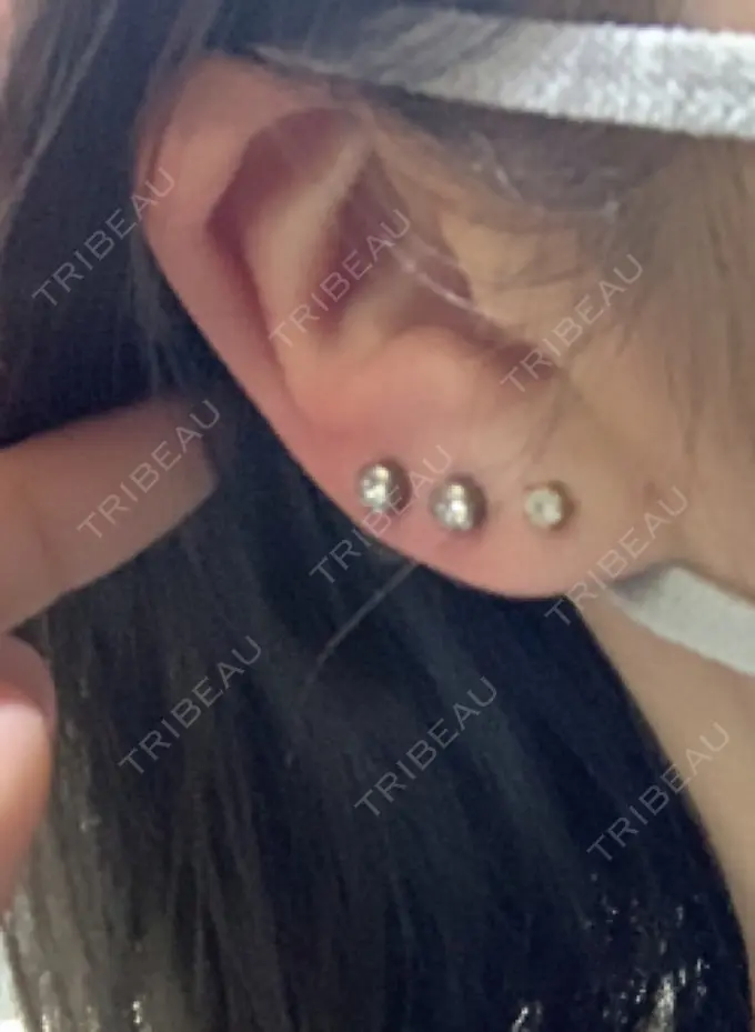 ピアス穴あけ アイ&スキンクリニック東京ソラマチ AFTER メイン用