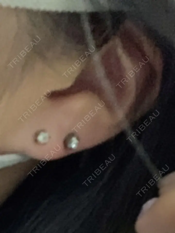 ピアス穴あけ アイ&スキンクリニック東京ソラマチ DAY 1 メイン用