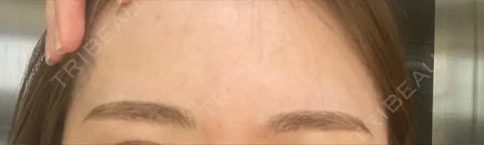アートメイク（眉） 表参道メディカルクリニック 福岡天神院 DAY 0 メイン用
