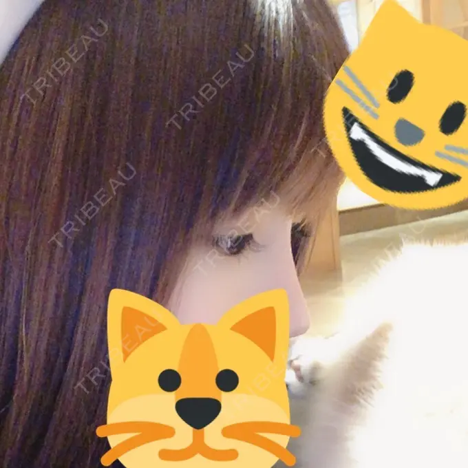 隆鼻術 / 軟骨移植 / プロテーゼ除去 FROM B整形外科 (旧バウム整形外科) DAY 247 メイン用