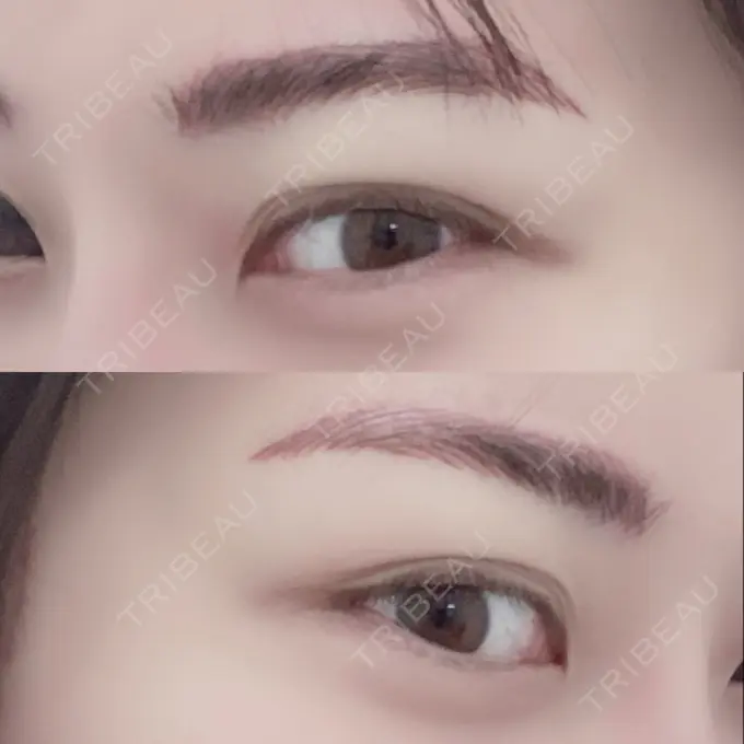 その他（肌） / アートメイク（眉） アモーレクリニック 名古屋院 DAY 0 メイン用