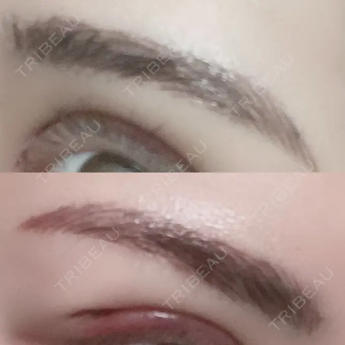 その他（肌） / アートメイク（眉） アモーレクリニック 名古屋院 DAY 1 メイン用