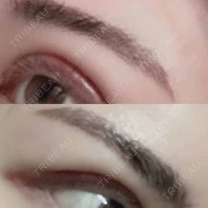 その他（肌） / アートメイク（眉） アモーレクリニック 名古屋院 DAY 2 メイン用