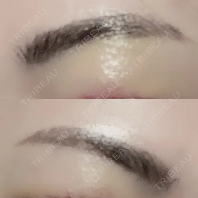 その他（肌） / アートメイク（眉） アモーレクリニック 名古屋院 DAY 4 メイン用