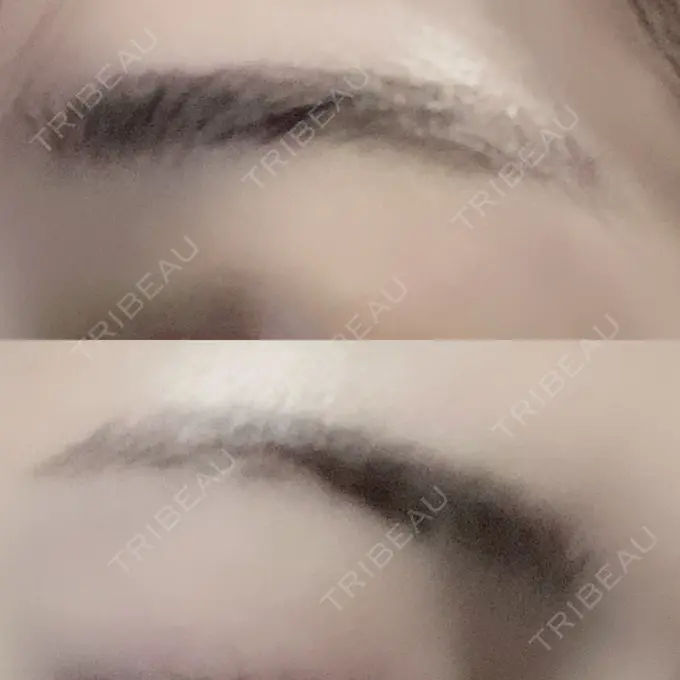 その他（肌） / アートメイク（眉） アモーレクリニック 名古屋院 AFTER メイン用