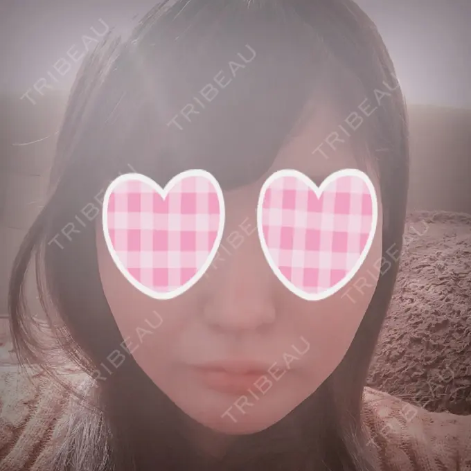 バッカルファット除去 / 脂肪吸引（顔） / ボトックス（あご） / ヒアルロン酸注入（あご） / ボトックス（エラ・小顔） / ヒアルロン酸注入（唇） / ボトックス（口角） エートップ美容整形外科 DAY 78 メイン用