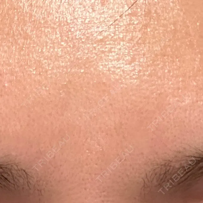 美容点滴・美容注射（美肌） 品川スキンクリニック広島院 DAY 3 メイン用