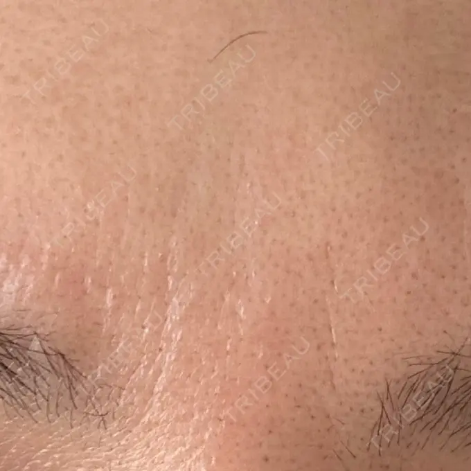 美容点滴・美容注射（美肌） 品川スキンクリニック広島院 DAY 4 メイン用