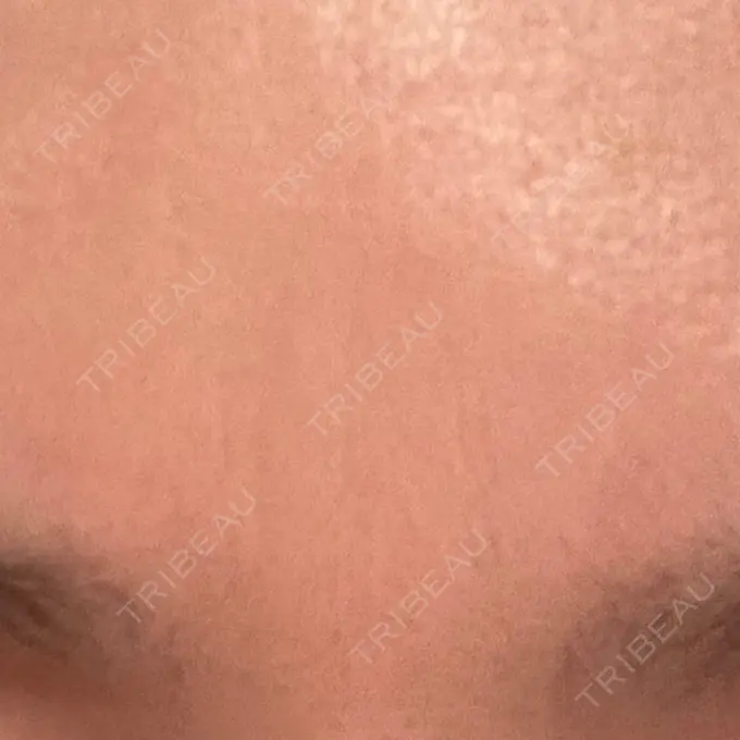 美容点滴・美容注射（美肌） 品川スキンクリニック広島院 DAY 5 メイン用