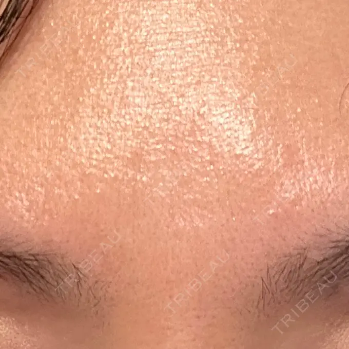 美容点滴・美容注射（美肌） 品川スキンクリニック広島院 DAY 7 メイン用