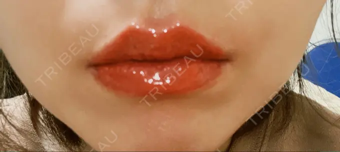 アートメイク（唇） LEAGRANT CLINIC 中目黒 DAY 0 メイン用