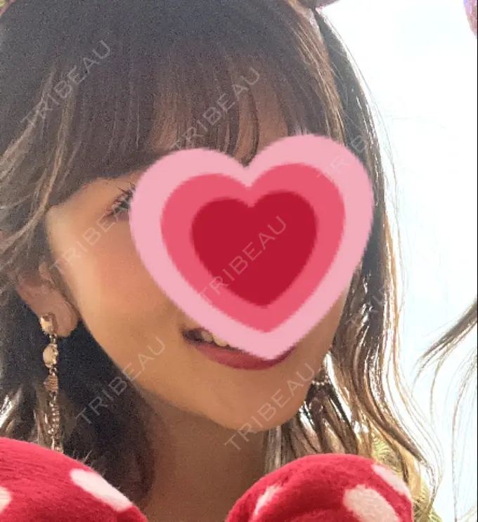 脂肪吸引（顔） / ジョールファット除去 / ボトックス（エラ・小顔） Otus Clinic 【オータスクリニック】 DAY 79 メイン用