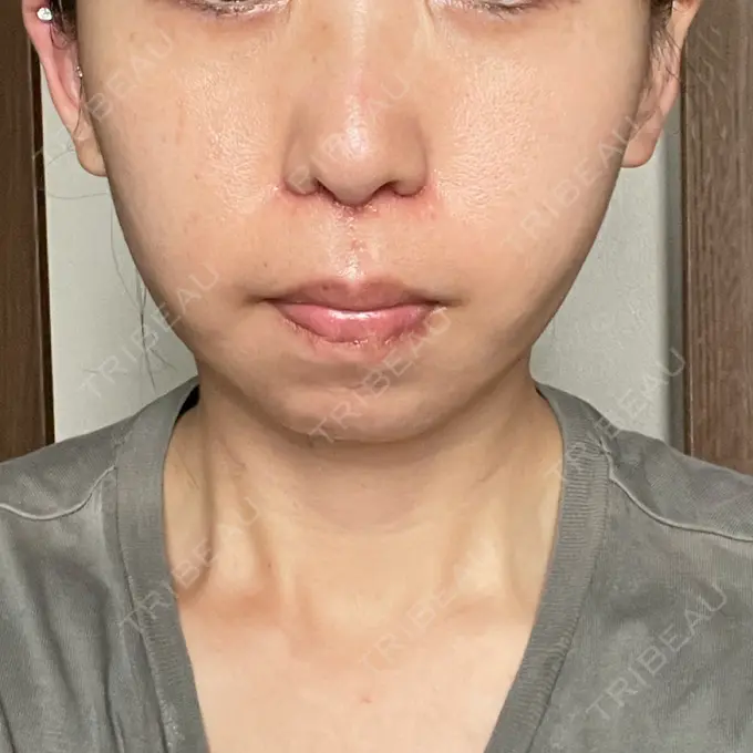 人中短縮 Otus Clinic 【オータスクリニック】 DAY 14 メイン用