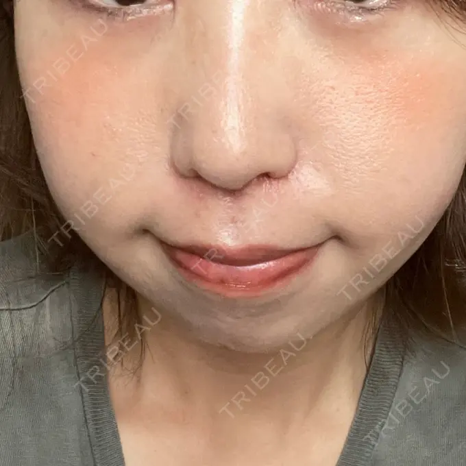 人中短縮 Otus Clinic 【オータスクリニック】 DAY 16 メイン用