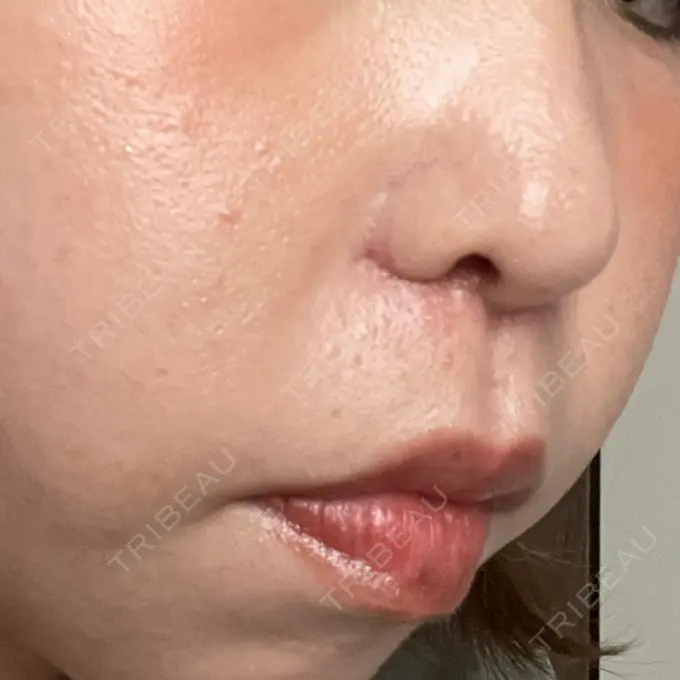 人中短縮 Otus Clinic 【オータスクリニック】 DAY 16 メイン用