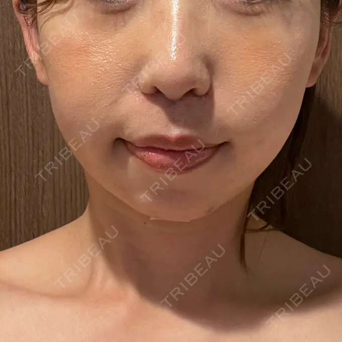 人中短縮 Otus Clinic 【オータスクリニック】 DAY 20 メイン用