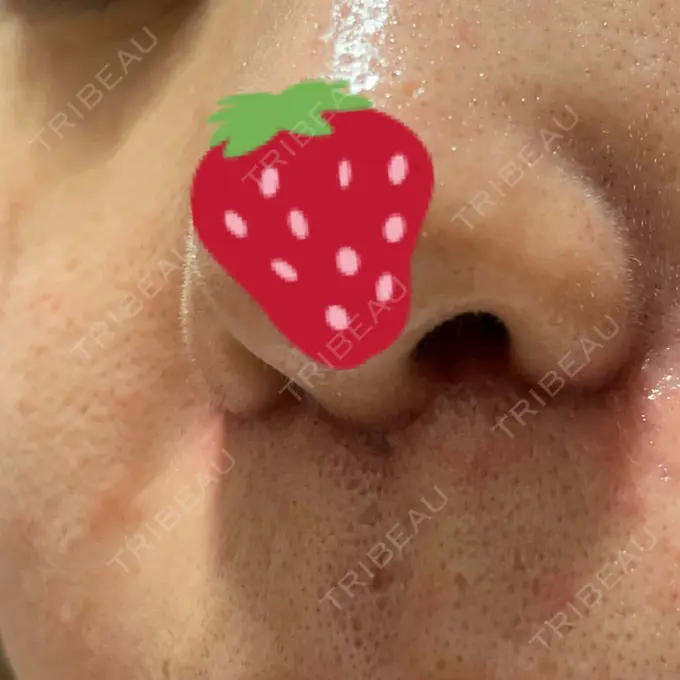 人中短縮 Otus Clinic 【オータスクリニック】 DAY 20 メイン用