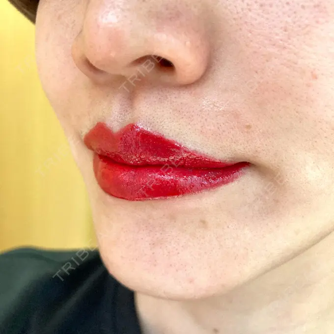 アートメイク（唇） エースクリニック 大阪梅田HEPナビオ院 DAY 57 メイン用