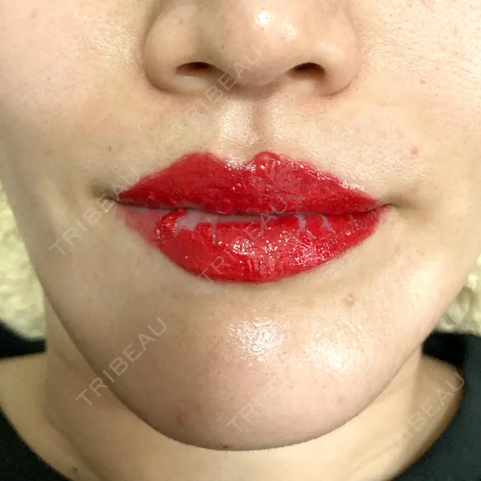 アートメイク（唇） エースクリニック 大阪梅田HEPナビオ院 DAY 59 メイン用