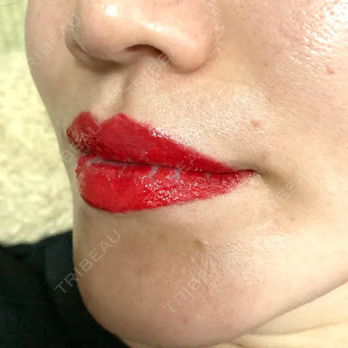 アートメイク（唇） エースクリニック 大阪梅田HEPナビオ院 DAY 59 メイン用