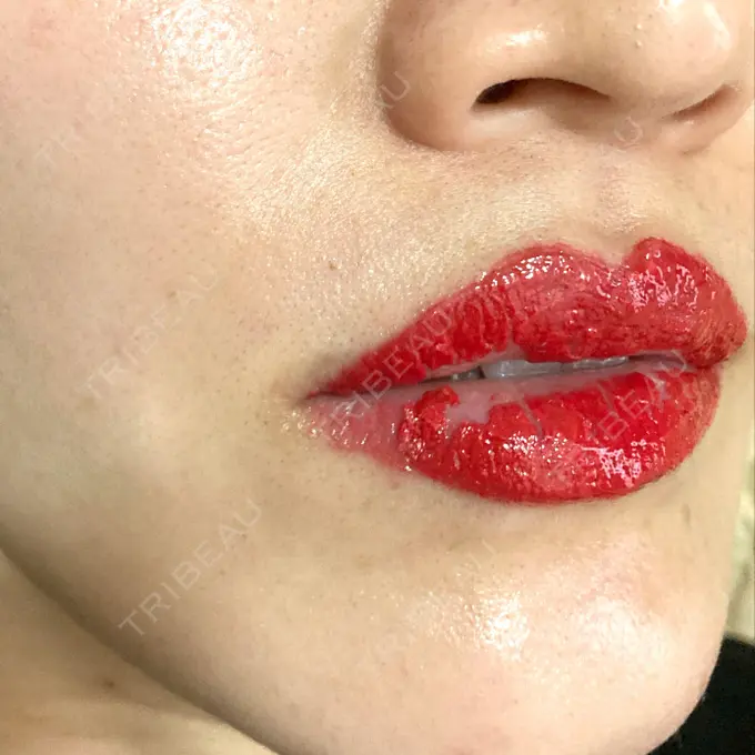 アートメイク（唇） エースクリニック 大阪梅田HEPナビオ院 DAY 59 メイン用