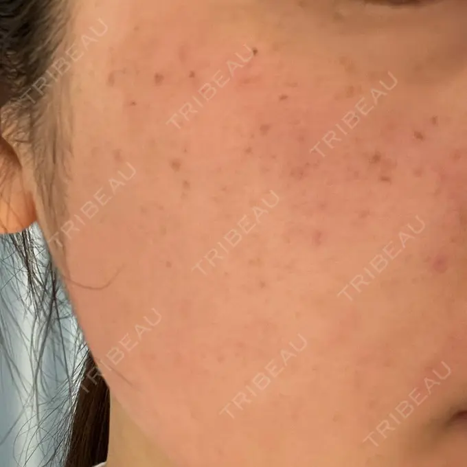 ルメッカ 豊洲内科・糖尿病 / 形成・美容外科クリニック DAY 0 メイン用