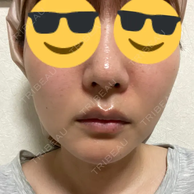 ルメッカ シェリークリニック 福岡院 AFTER メイン用