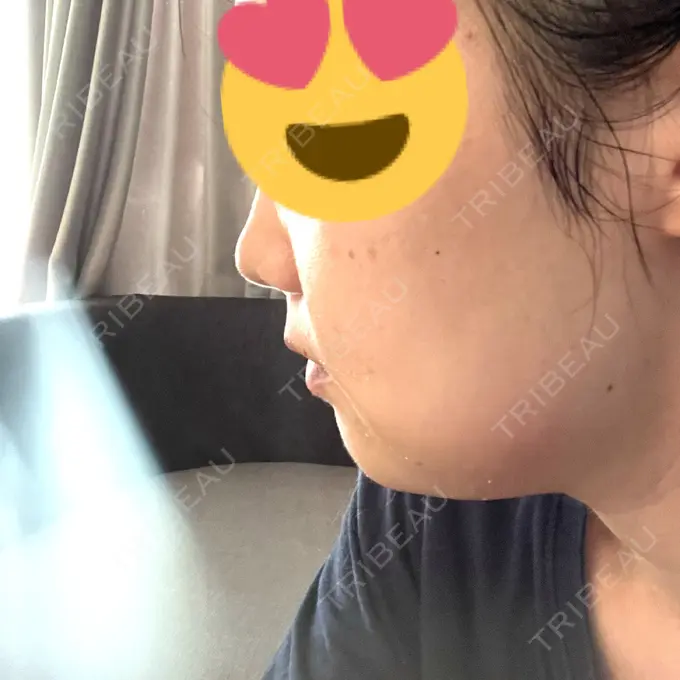 セットバック カトレア歯科・美容クリニック DAY 3 メイン用