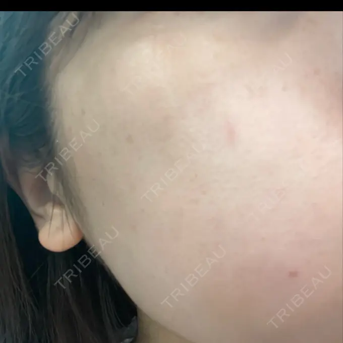 ルメッカ 豊洲内科・糖尿病 / 形成・美容外科クリニック DAY 7 メイン用