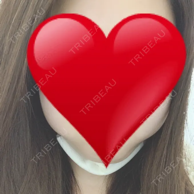 ボトックス（エラ・小顔） / 脂肪溶解注射（顔） 湘南美容クリニック 名古屋栄院 AFTER メイン用