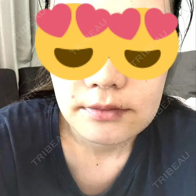 セットバック カトレア歯科・美容クリニック DAY 3 メイン用