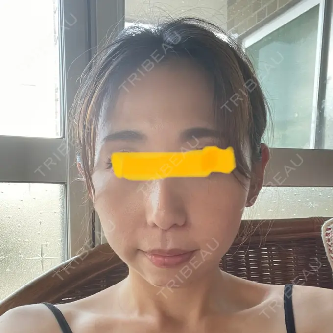 人中短縮 Otus Clinic 【オータスクリニック】 DAY 48 メイン用