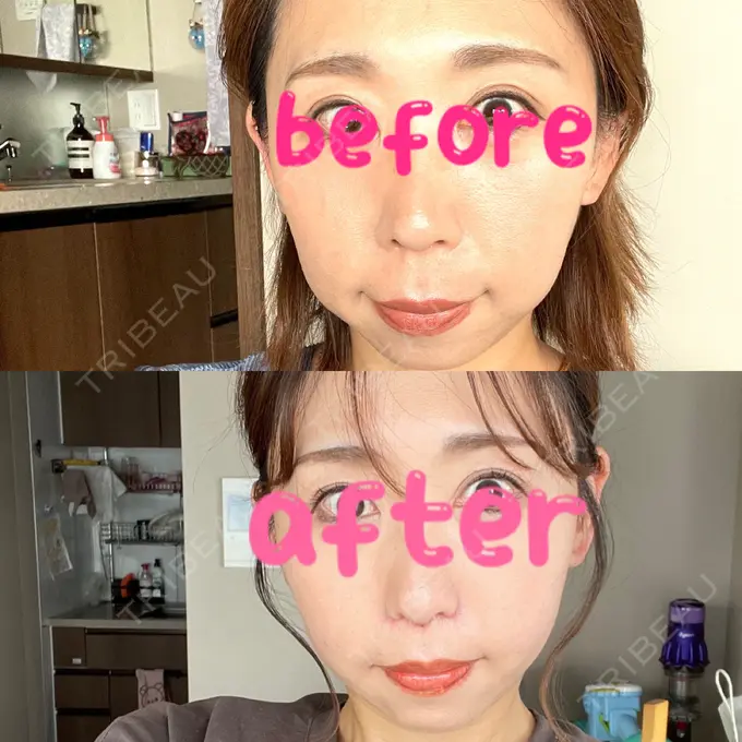 人中短縮 Otus Clinic 【オータスクリニック】 AFTER メイン用