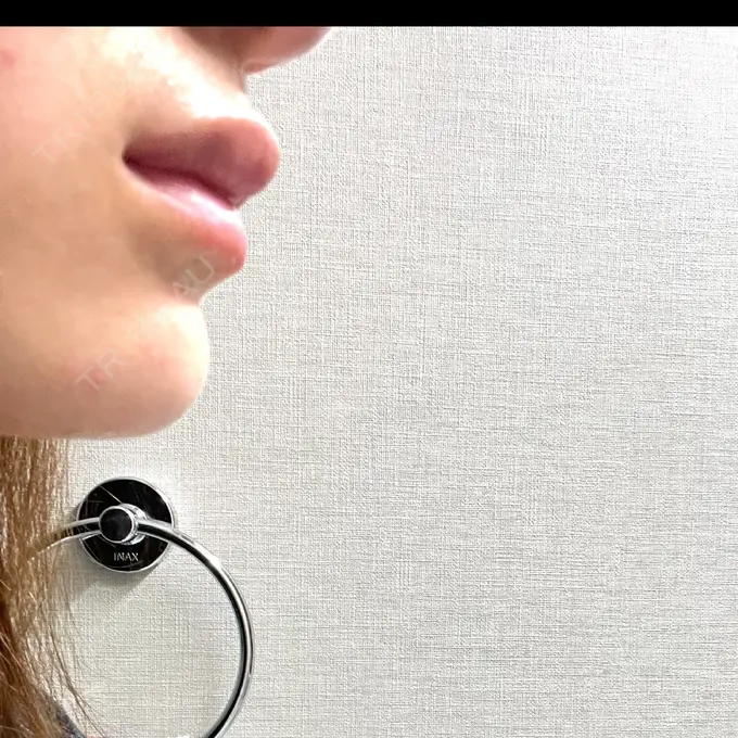 ボトックス（エラ・小顔） / ヒアルロン酸注入（唇） Dual Clinic SHINSAIBASHI DAY 2 メイン用