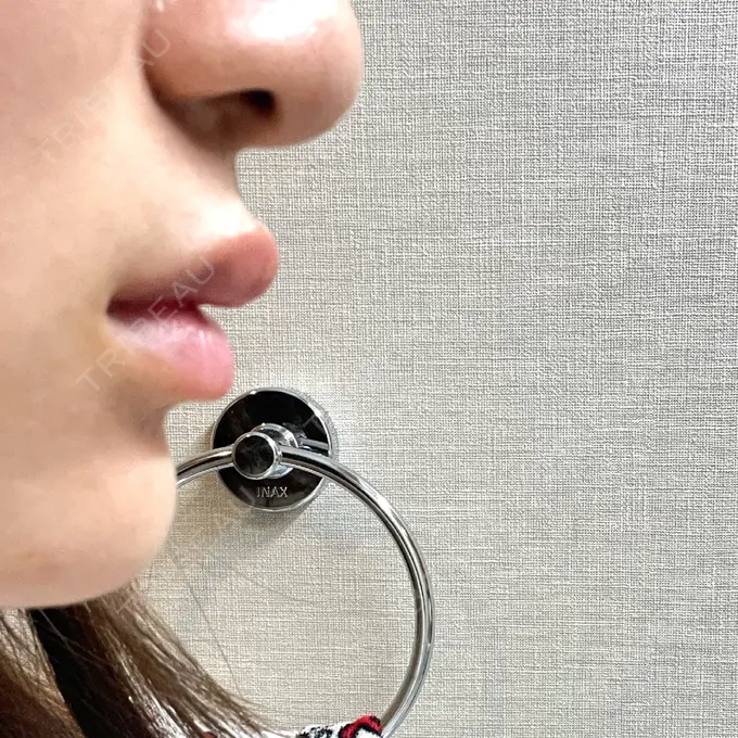 ボトックス（エラ・小顔） / ヒアルロン酸注入（唇） Dual Clinic SHINSAIBASHI DAY 3 メイン用