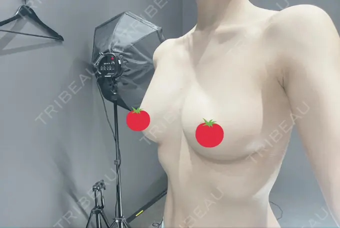 脂肪吸引（二の腕） / 脂肪吸引（脚） / 豊胸（脂肪注入） / 脂肪吸引（肩） Casa de GRACIA GINZA 【カーサデグラシアギンザ】 DAY 193 メイン用