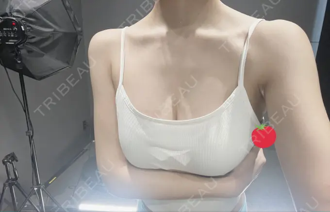 脂肪吸引（二の腕） / 脂肪吸引（脚） / 豊胸（脂肪注入） / 脂肪吸引（肩） Casa de GRACIA GINZA 【カーサデグラシアギンザ】 DAY 193 メイン用