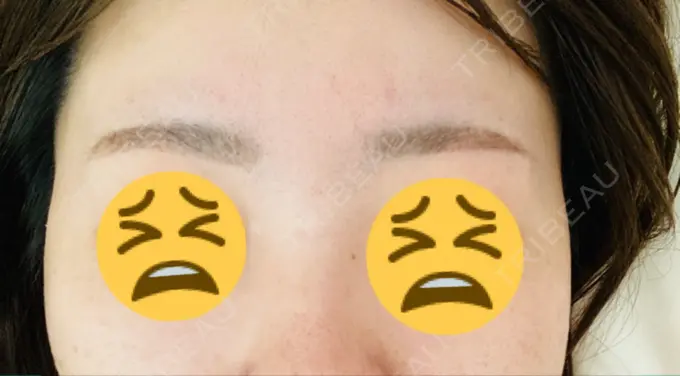 アートメイク（眉） 三鷹ヒロクリニック 北口院 （医療脱毛） AFTER メイン用