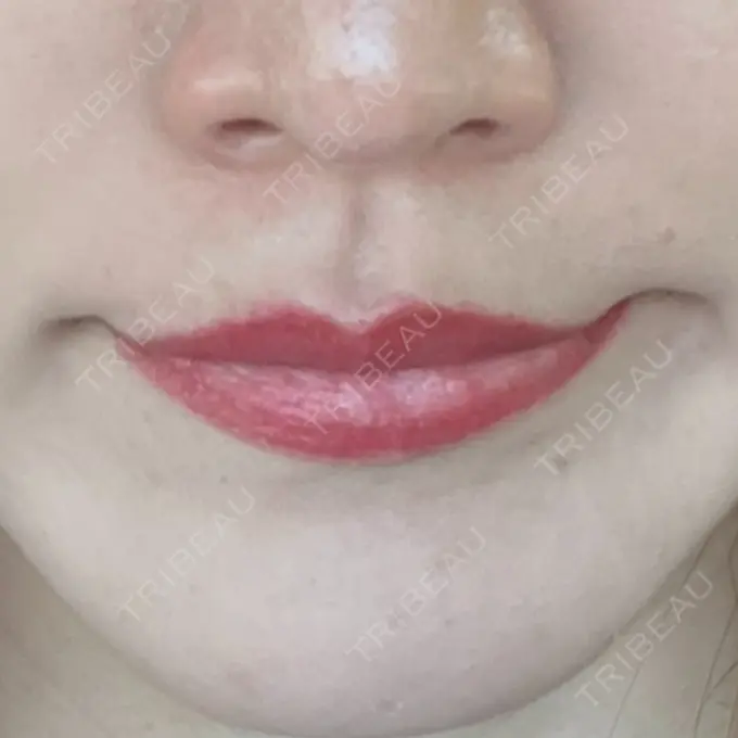 アートメイク（唇） エースクリニック 大阪梅田HEPナビオ院 AFTER メイン用
