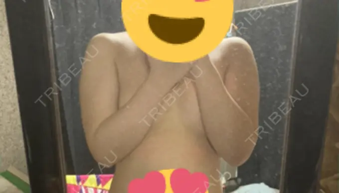 脂肪吸引（二の腕） 湘南美容クリニック 新潟院 BEFORE メイン用