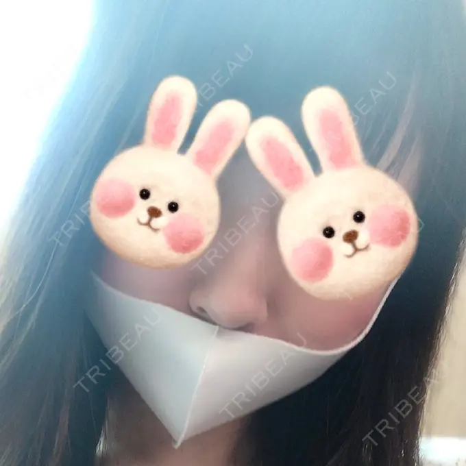 鼻尖形成（切開） / 軟骨移植 / 鼻尖縮小 / その他（鼻） みずほクリニック BEFORE メイン用