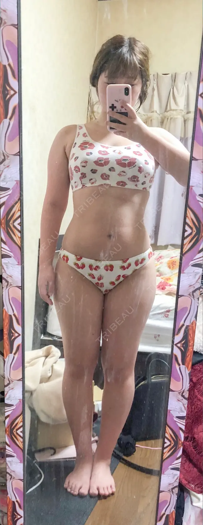 脂肪吸引（脚） / 脂肪吸引（お尻） / ボトックス（ふくらはぎ） ラインカルチャークリニック BEFORE メイン用