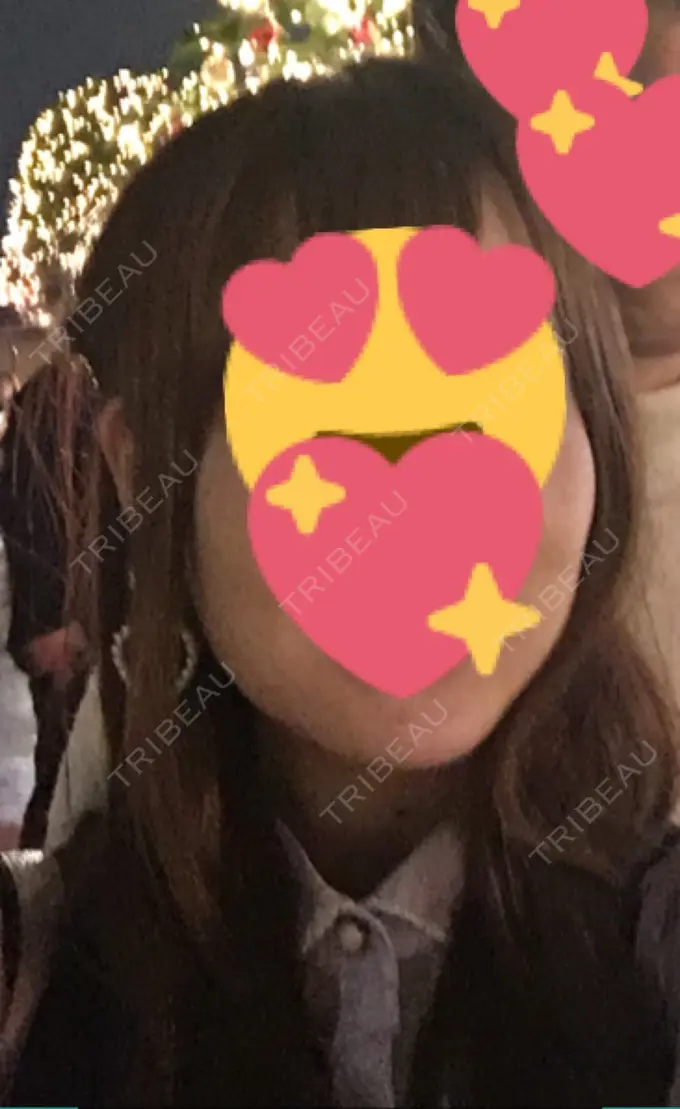 バッカルファット除去 / ボトックス（エラ・小顔） 湘南美容クリニック 秋葉原院 BEFORE メイン用